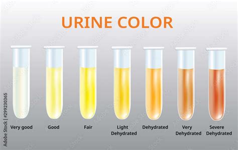 Urine Smells Smoky 7 Amazing Causes With Remedies