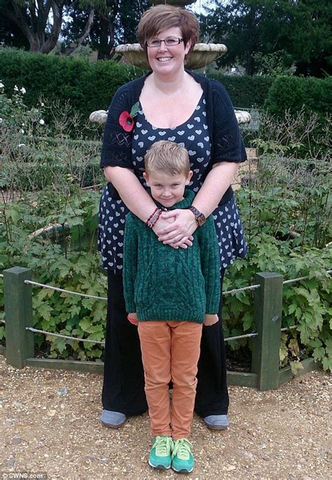 Obese Mother Is Left With Tree Trunk Legs Due To Rare Condition Despite Drastic Weight Loss