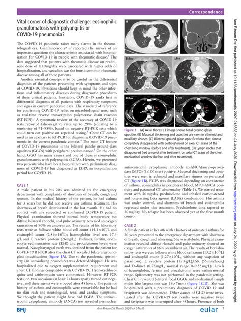 Pdf Vital Corner Of Diagnostic Challenge Eosinophilic Granulomatosis