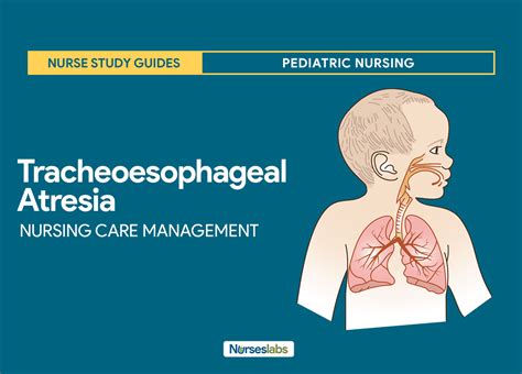 Tracheoesophageal Atresia Nursing Care Management And Study Guide