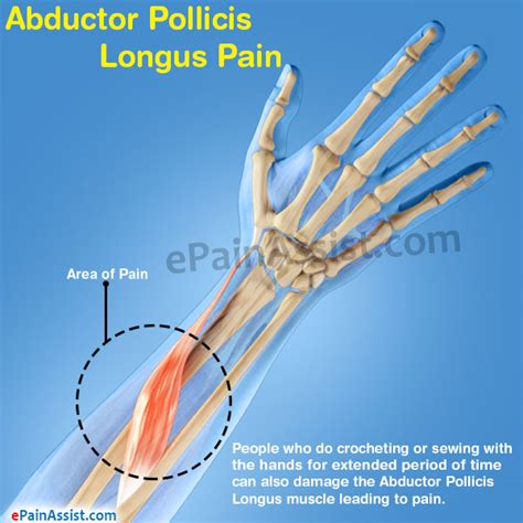 Abductor Pollicis Longus Painsignssymptomscausestreatment