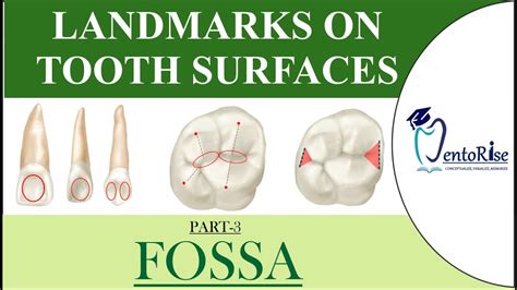 Landmarks On Tooth Surfaces Part3 Fossa Dental Terminology Tooth Landmarks Dental