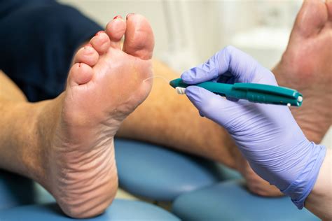 Diabetic Foot Care Total Foot Health