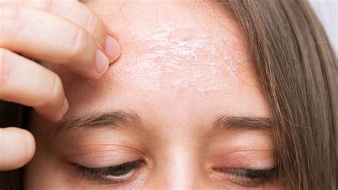15 Causes For Dry Skin On Your Face And How To Treat Them