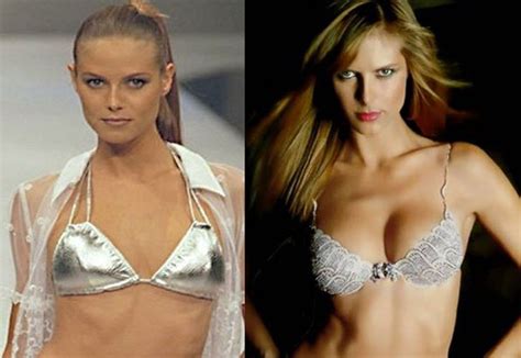 Top 7 Victorias Secret Models Whove Had Plastic Surgery