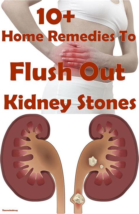 10 Home Remedies To Flush Out Kidney Stones Kidney Stones Remedy