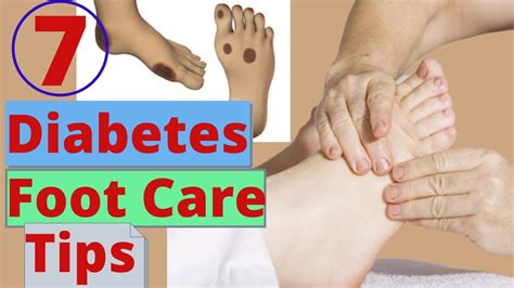 7 Diabetes Foot Care Tips Youtube