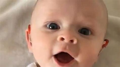 Video Shows Moment Deaf Baby Hears For First Time With Hearing Aids