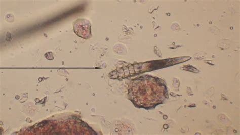 Demodectic Mange Demodex Demodex Canis Seen Under Microscope At 40