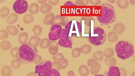 Blincyto Prolongs Survival In Acute Lymphoblastic Leukemia All