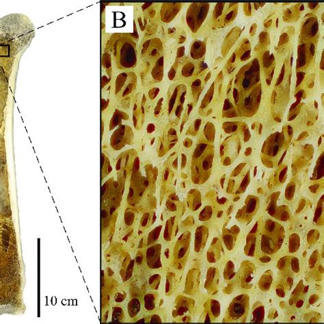 Cancellous Bone Occurrence And Macrostructure As Illustrated Here With