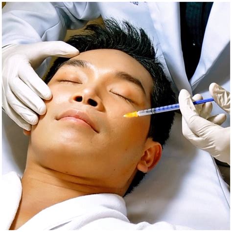 Acne Face Treatment With Injection Rederm Medical Center