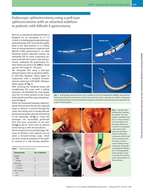 Pdf Endoscopic Sphincterotomy Using A Pull Type Sphincterotome With