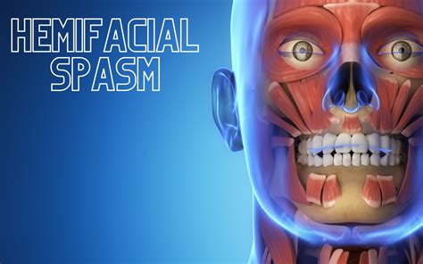 Hemifacial Spasm Conditions And Treatments What Is It