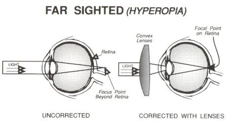 Whats My Prescription Mean Optometry Blog Wink Optometry
