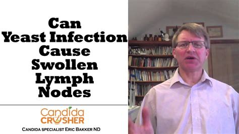 Can A Yeast Infection Cause Swollen Lymph Nodes Youtube