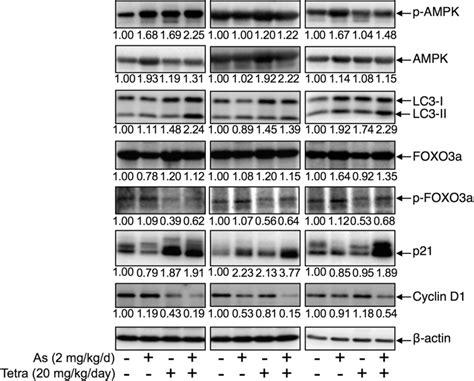 Expression Profile Of Autophagy And Cell Cycle Arrest Related Proteins