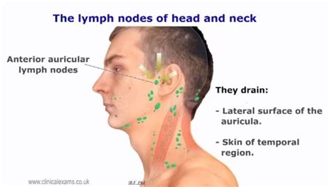 Normal canine head and neck lymph nodes have been described as being homogeneous and hypointense. Lymph node | Mouth and throat - Anatomy and conditions ...