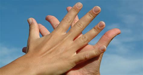 Home Remedies To Remove Warts On Fingers Livestrongcom