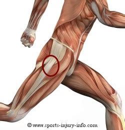 A prior injury in the same area. Left HIP soreness, cant do squats. Massage therapist says ...