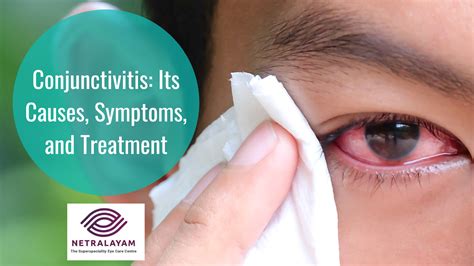 Conjunctivitis Its Causes Symptoms And Treatment