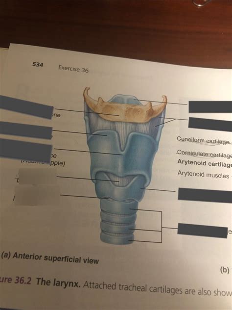 The Larynx Anterior Superficial View Diagram Quizlet