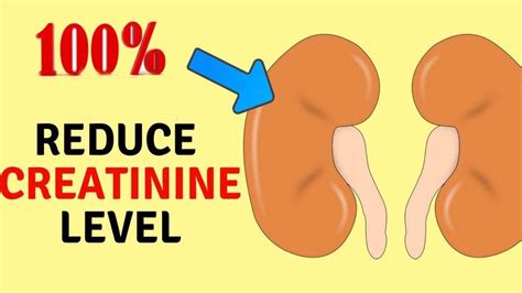8 Easy Ways To Reduce Creatinine Level Fast And Improve Kidney Health