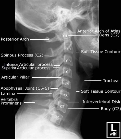 Labeled Cervical Spine Xray Anatomy Lateral View Anatomy Grepmed