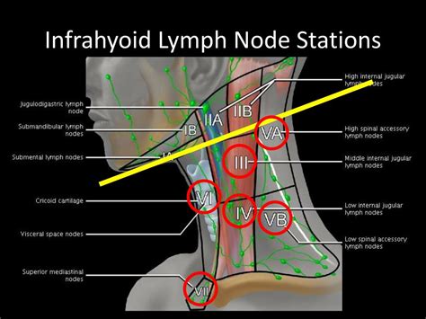 Cervical Lymph Node Stations Images News Current Station In The Word