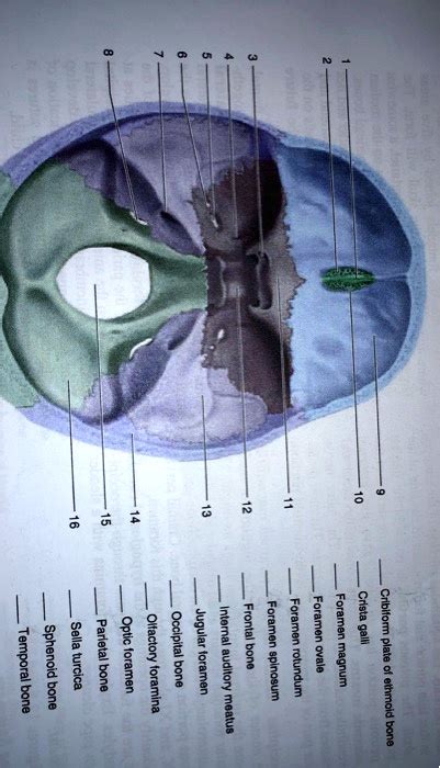SOLVED 15 14 16 Sella Turcica Parietal Bone Optic Foramen Olfactory