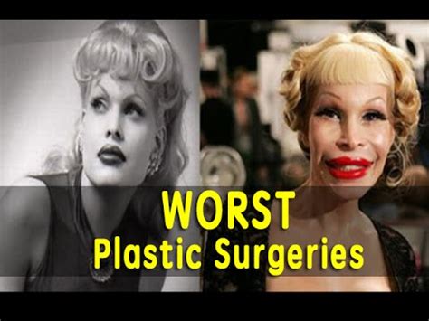 Top Worst Plastic Surgeries Ever Youtube