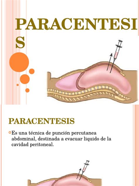 Paracentesis Especialidades Medicas Medicina Clinica