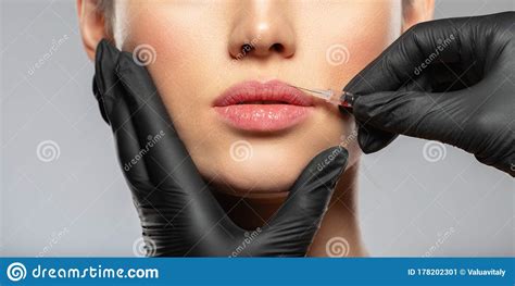 Mujer Cauc Sica Con Inyecci N Cosm Tica Botox En Los Labios La Mujer