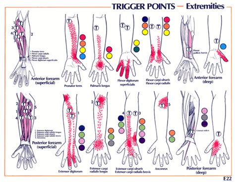 Relieve Hand And Wrist Pain With Trigger Point Therapy