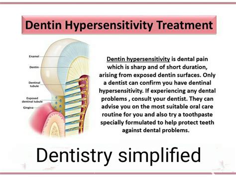 Dentin Hypersensitivity
