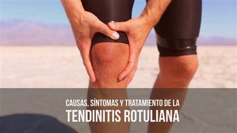 Causas Sintomas Tratamiento Tendinitis Rotuliana Tendinitis Rotuliana