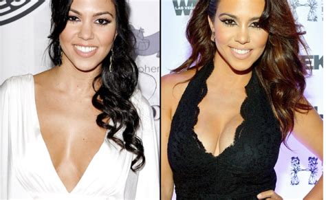 Breast Augmentation Before And After Celebrity Edition Atlantic Health Solutions
