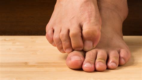 What Does It Really Mean When Your Toes Itch