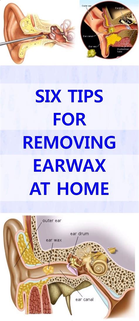 Six Tips For Removing Earwax At Home Ear Wax Ear Wax Removal
