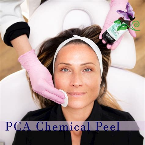 Pca Skin Chemical Peel Shannon S Serendipity Skincare Las Vegas