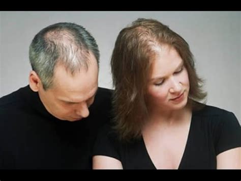 What causes hair loss in women? Effective Hair Loss Treatment For Male and Female Pattern ...