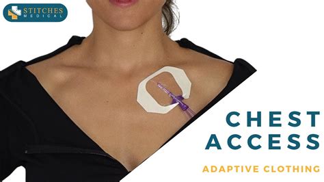 Chest Access Clothing Making Ports Infusaports And Chest Catheters
