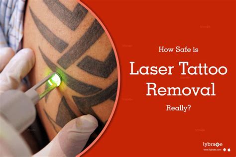 How Safe Is Laser Tattoo Removal Really By Dr Jolly Shah Kapadia