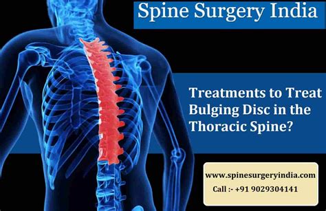 What Are The Treatments To Treat Bulging Disc In The Thoracic Spine