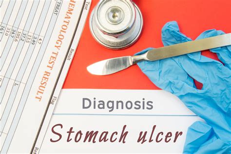 10 Popular Treatments For Stomach Ulcers Facty Health