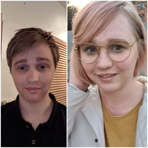 25 Months Of Hrt I Hope There Are Little Changes Scrolller