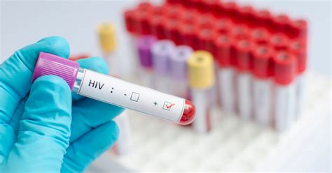 A Promising Study Reveals New Hope For An Hiv Cure Huffpost