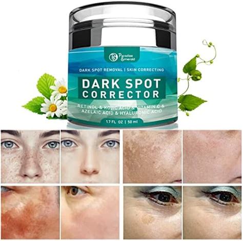 Paradise Emerald Dark Spot Remover For Face Hyperpigmentation