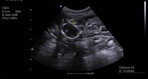 Feline Pregnancy Scan In Bromley Animal Ultrasound Association