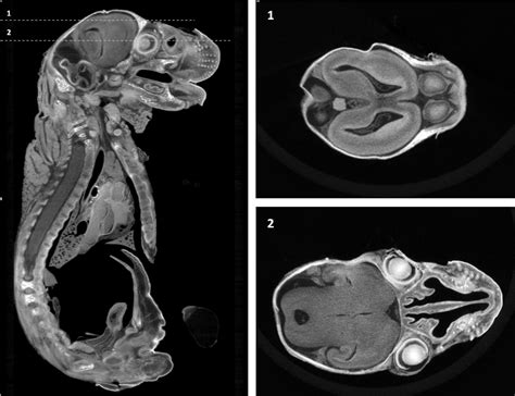 Contrast Enhanced High Resolution Ct Imaging On Tissue Specimens Biomedical Research Imaging